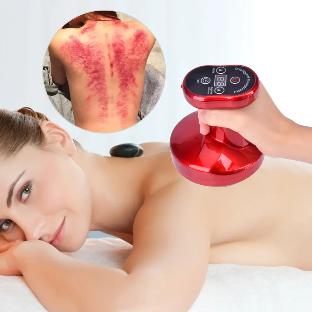 Electric Cupping Therapy Massage Scraping Physiotherapy Medical Chinese Gua Sha Anti Cellulite Suction Weight Loss Vacuum Cans