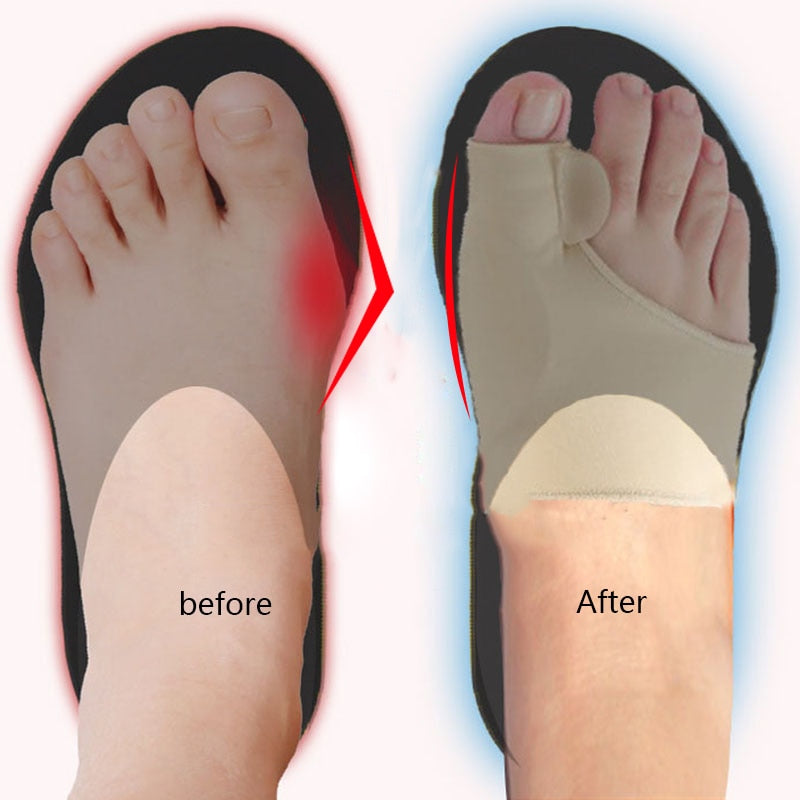 Big Toe Splint Separator Hallux Valgus Bunion Corrector Orthotic Feet Care Thumb Adjuster Correction Pedicure Socks Straightener